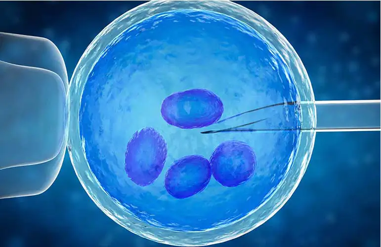 In Vitro Fertilization (IVF)