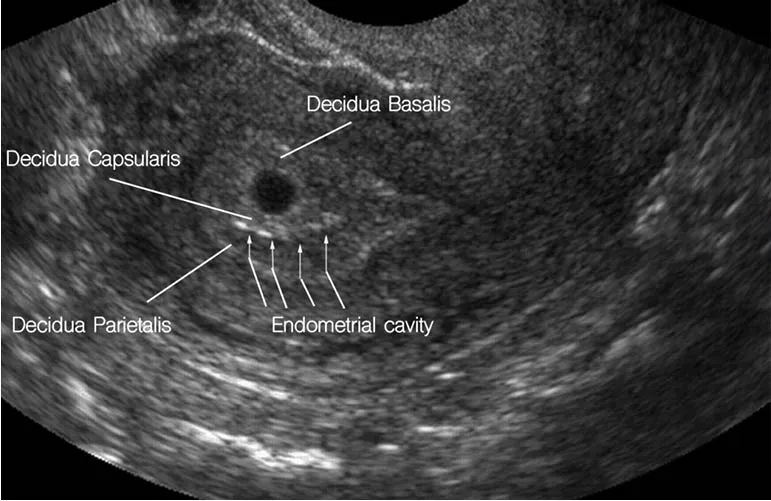 Obstetrics Sonography